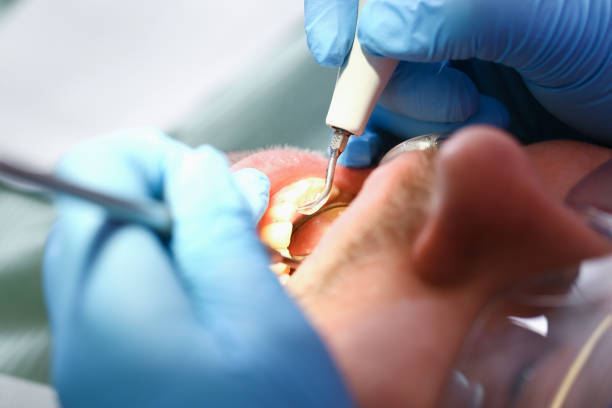 Best Broken or Cracked Tooth Emergency Dentist in Idyllwild Pine Cove, CA
