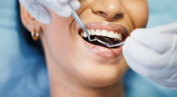 Best Broken or Cracked Tooth Emergency Dentist in Idyllwild Pine Cove, CA